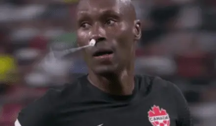 “Is that a tampon?”: Canada has interesting way to treat World Cup injury | Offside