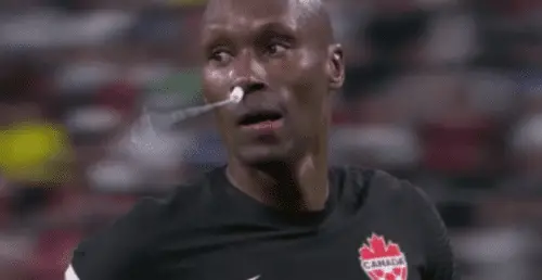 “Is that a tampon?”: Canada has interesting way to treat World Cup injury | Offside